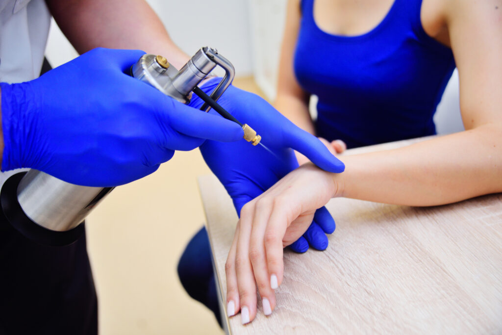 the doctor the dermatologist doing the procedure - cryotherapy - cold treatment is a special apparatus with cryodestruction
