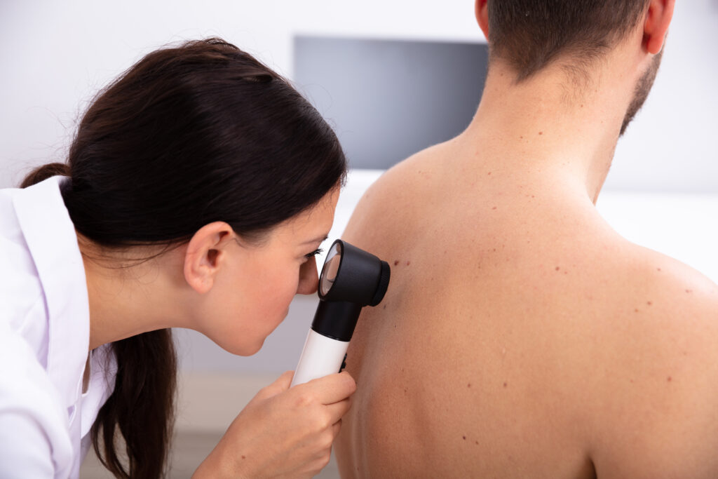 Female Doctor Examining Pigmented Skin On Man's Back With Dermatoscope