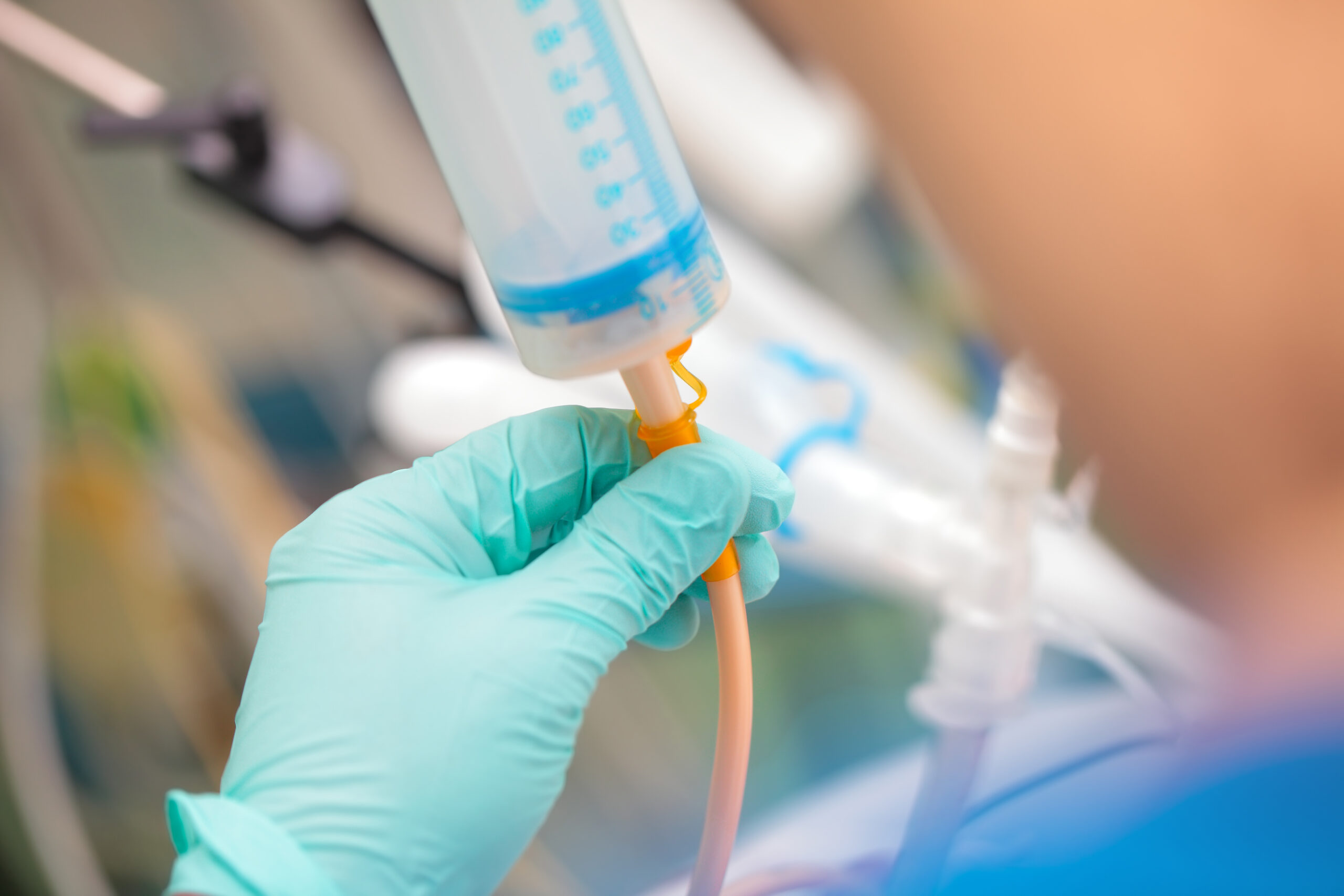 Doctor with a syringe Janet in his gloved hands enters enteral nutrition to the patient in the intensive care unit.
